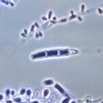 Trichophyton rubrum