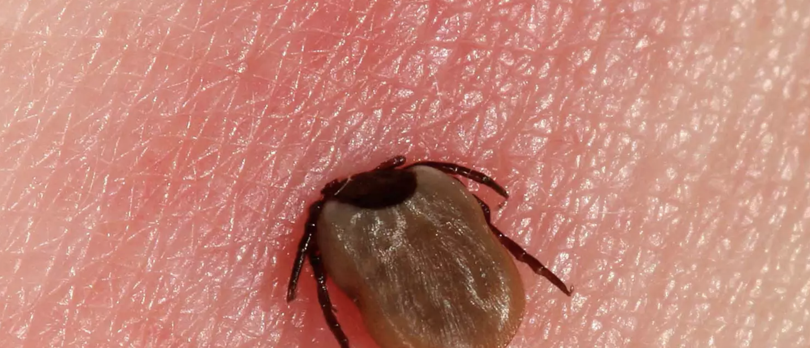 Piperacilline Lyme