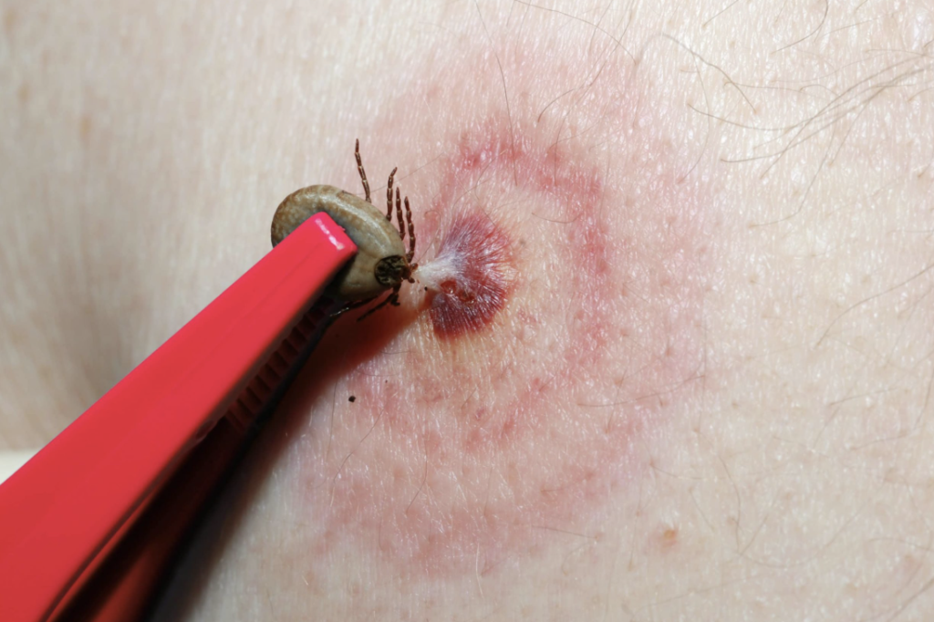 Piperacilline Lyme