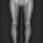 Pangonogramme