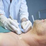 thyroide cytoponction