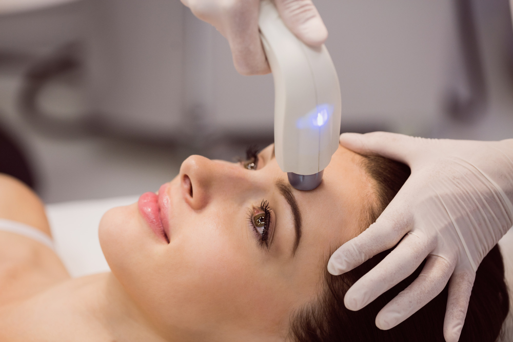 Laser dermatologique