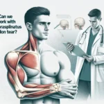 peut-on travailler avec une rupture du tendon supra épineux — guide complet