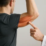 triceps court — guide complet